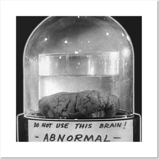 ABNORMAL Brain Jar Posters and Art